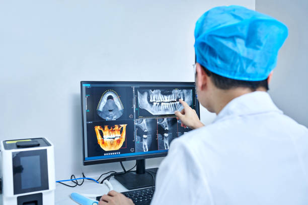 Best Emergency Tooth Extraction in San Jose, CA